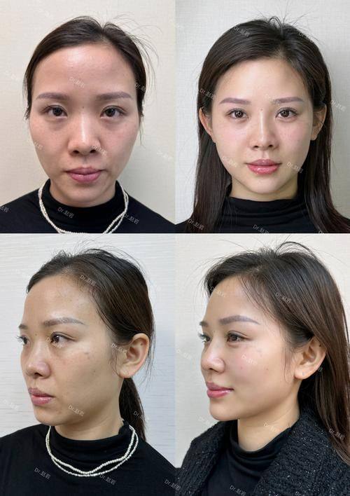 纳帕科伦医生口碑评价