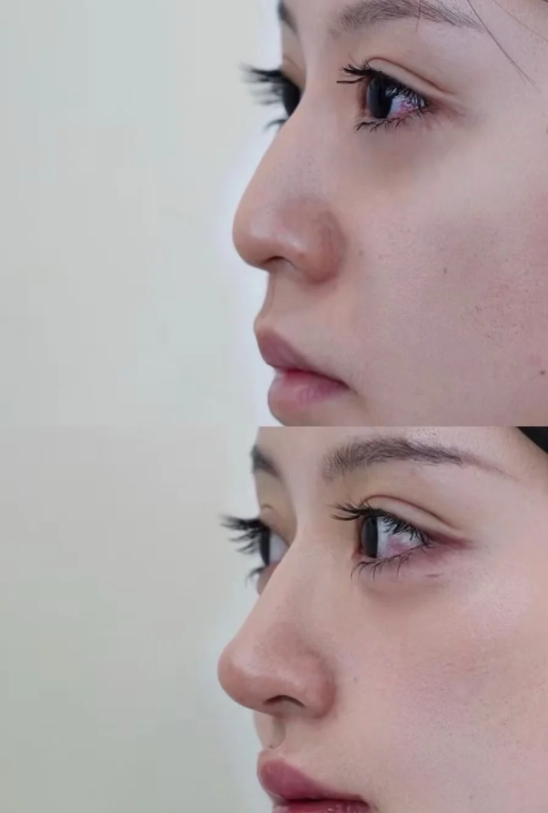 韩国CBK整形外科价格表