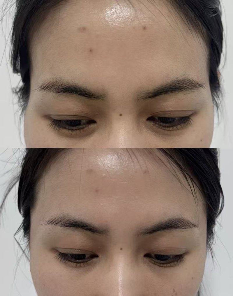 成都高新半山整形医院价格表：