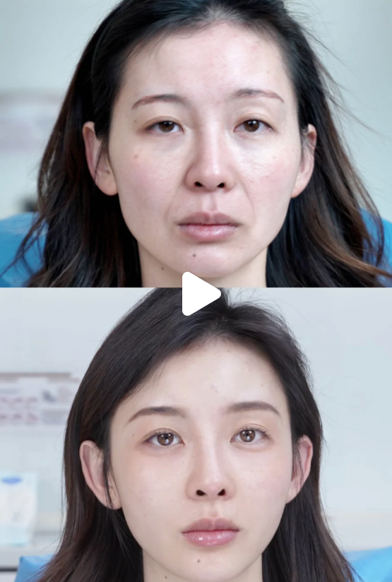 五、常见误区答疑