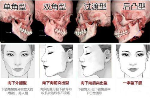 五、就医与术后注意事项