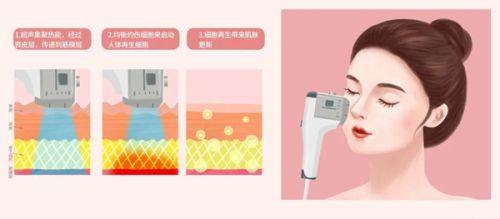 二、膨体隆鼻失败修复的间隔时间