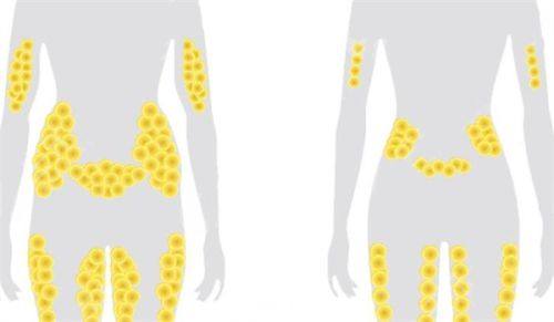 怎样自己去眼袋有效？自测眼袋类型选适配去眼袋方法避误区实用指南