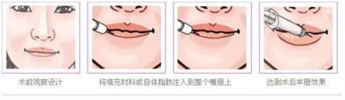 新乡金中民医学整形美容医院地址电话及营业时间