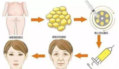 淄博友谊医院妇科整形擅长项目: