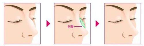 淄博友谊医院妇科整形价格表: