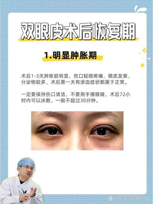 周光杰医生怎么预约？