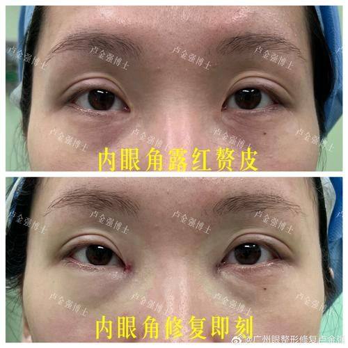 上海同德医院医疗美容科口碑评价：