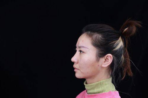 上海同德医院医疗美容科价格表：