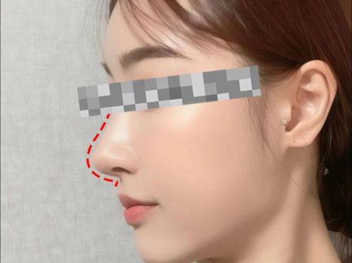 新乡金中民医学整形美容医院擅长项目