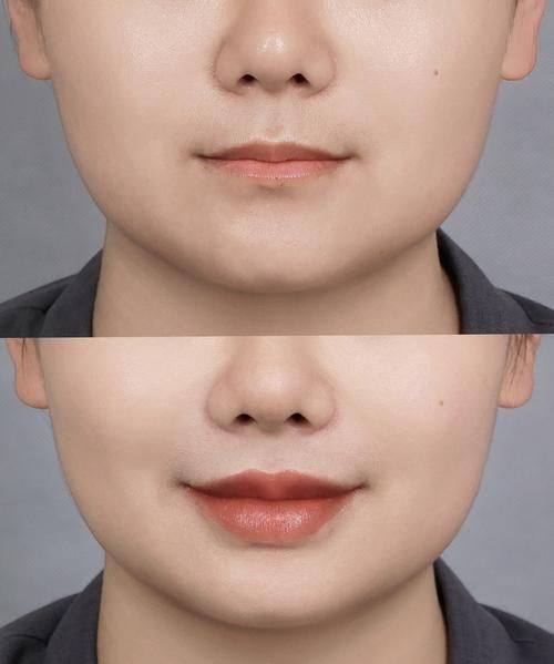 南昌丽睿医疗美容门诊部怎么样？