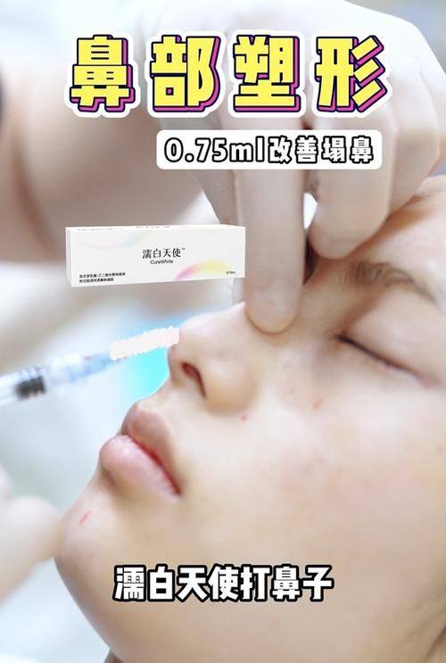 田莉医生怎么预约