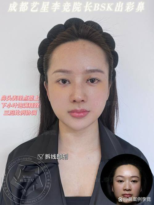 湘南美容 前桥怎么样?