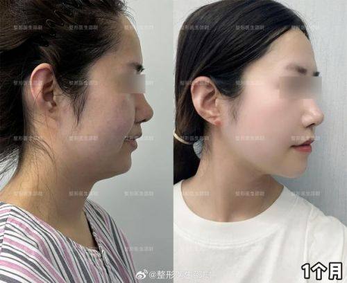 西安粉粉鹦医疗美容诊所口碑评价