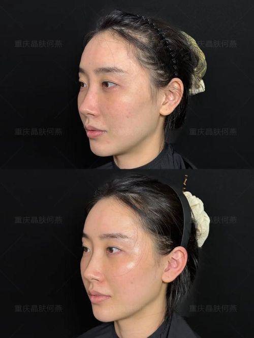 乌鲁木齐爱尚智尚整形医院口碑评价: