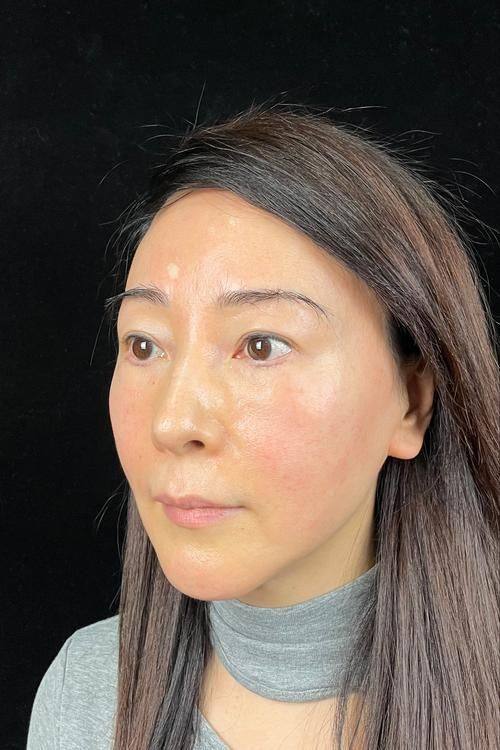 湘南美容 前桥价格表