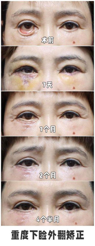 新乡金中民医学整形美容医院价格表