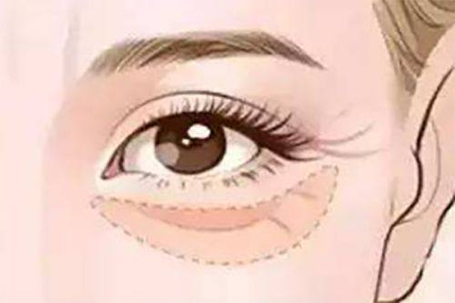 四、烫伤的疤痕怎么修复