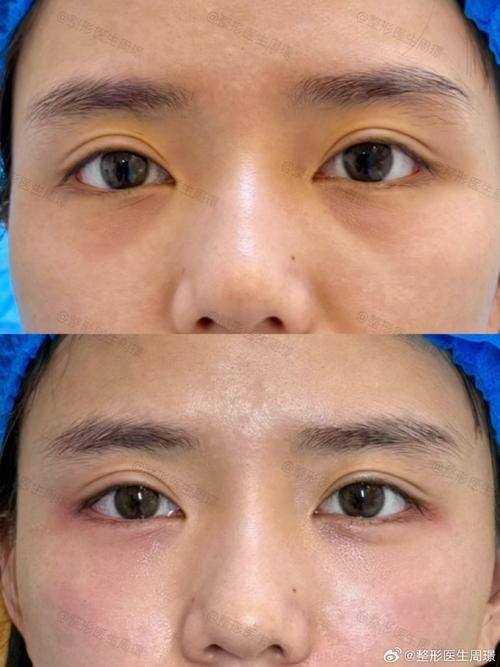 葛丽娜医生擅长领域: