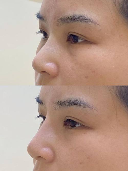 西安星颜靓影医疗美容诊所怎么样？