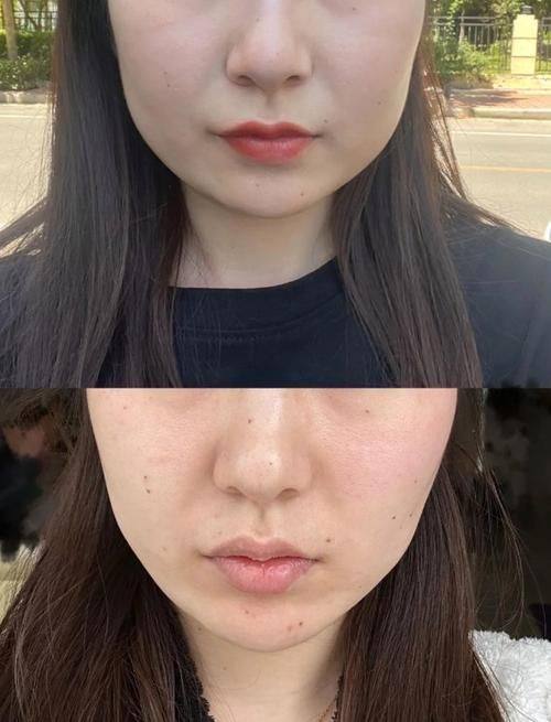 长沙美诺美和医疗美容门诊部口碑评价