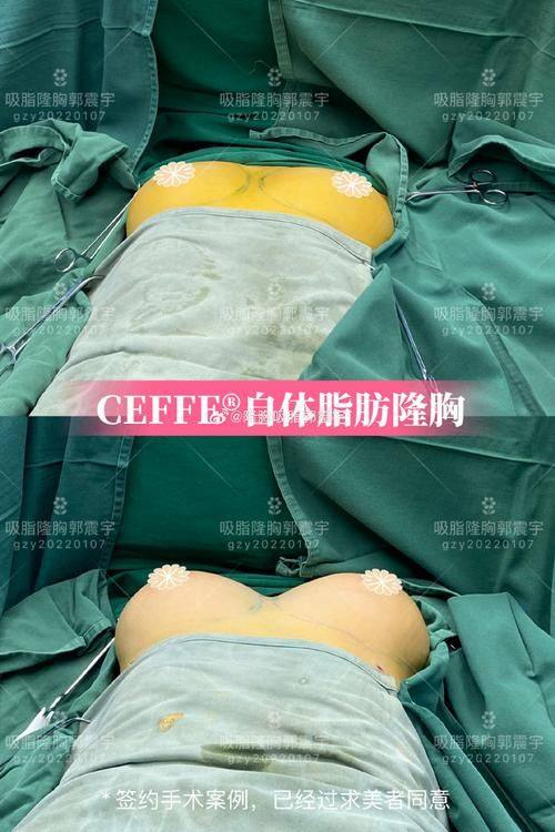 成都怡脂整形美容医院预约挂号方式