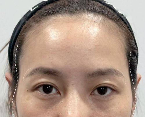 十堰熊本漾医疗美容门诊部擅长项目: