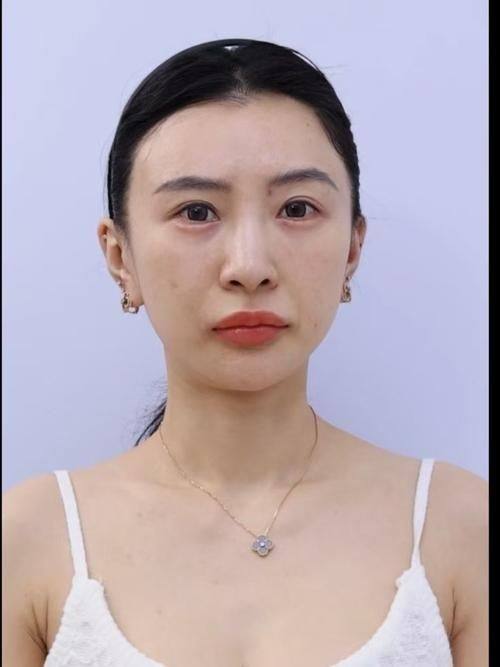 榆林市第二医院医疗美容科口碑评价: