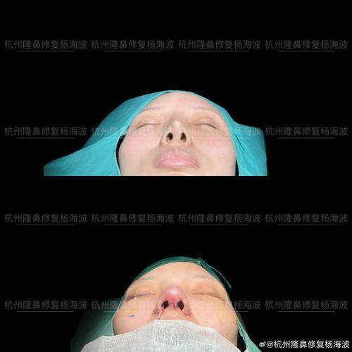 吴惠真医生口碑评价：