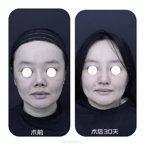 重庆奥斯蒂娜医学美容医院擅长项目：