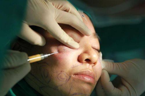 成都怡脂整形美容医院医生名单及擅长领域