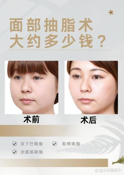 signature整形外科怎么样