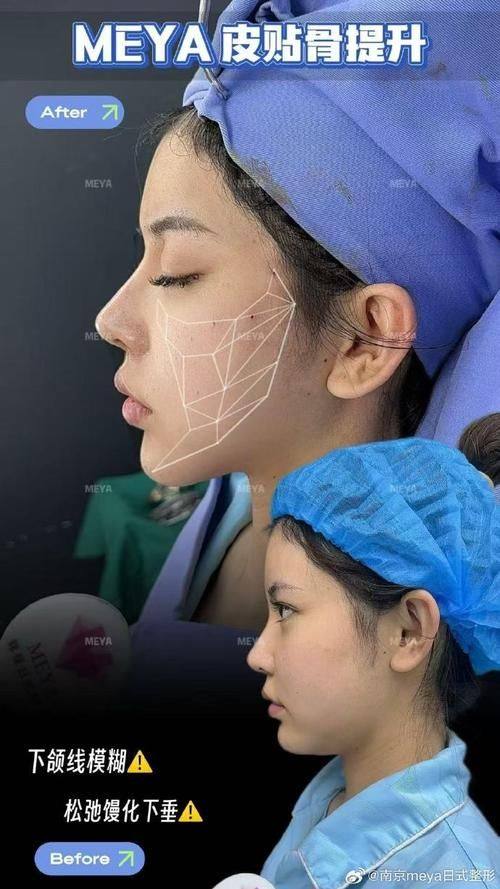 signature整形外科价格表