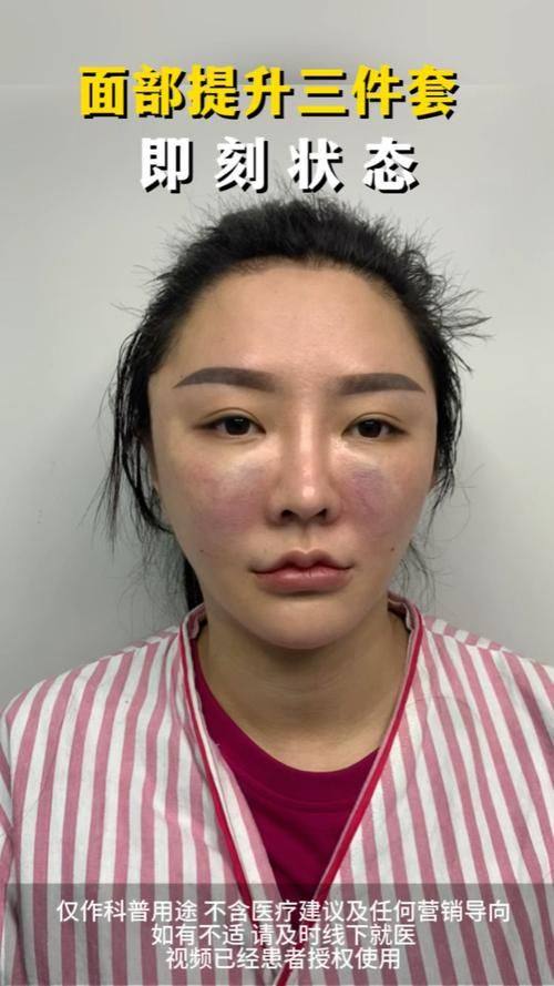 西安星颜靓影医疗美容诊所口碑评价：