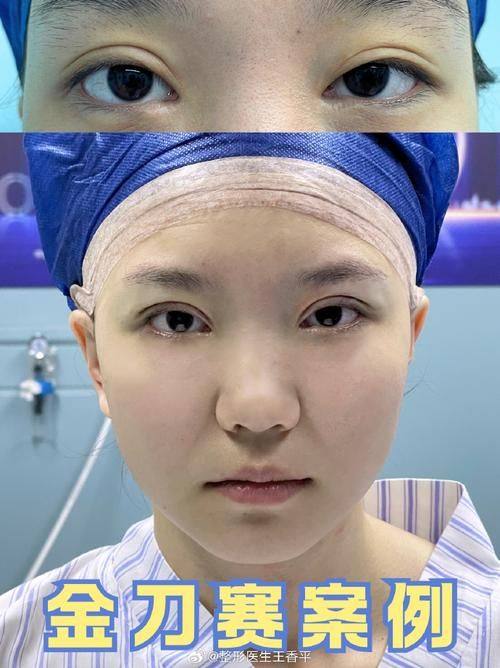 武汉禾丽康美整形医疗美容医院擅长项目: