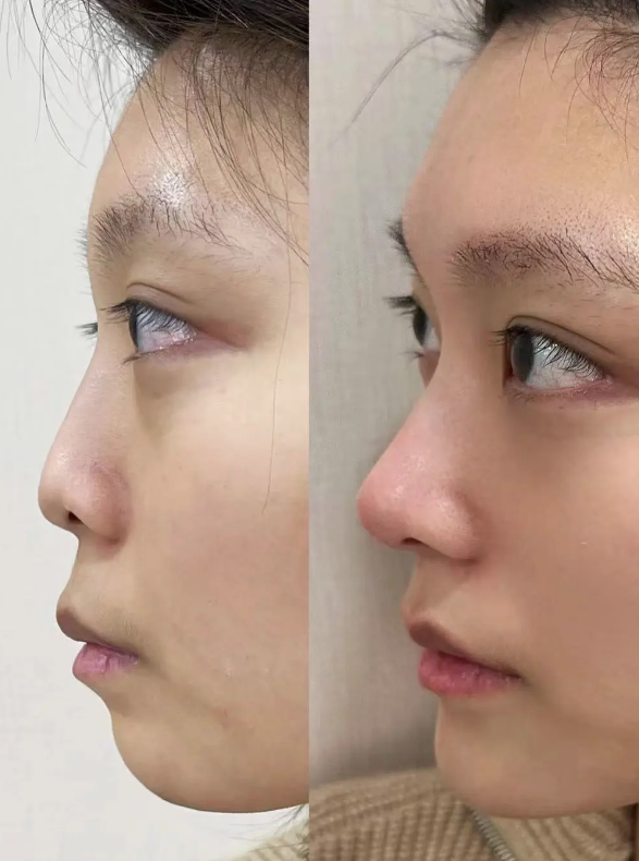 signature整形外科口碑评价