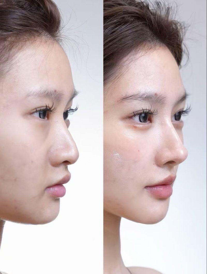 signature整形外科预约挂号方式