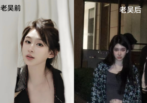 三、术前术后的关键注意事项