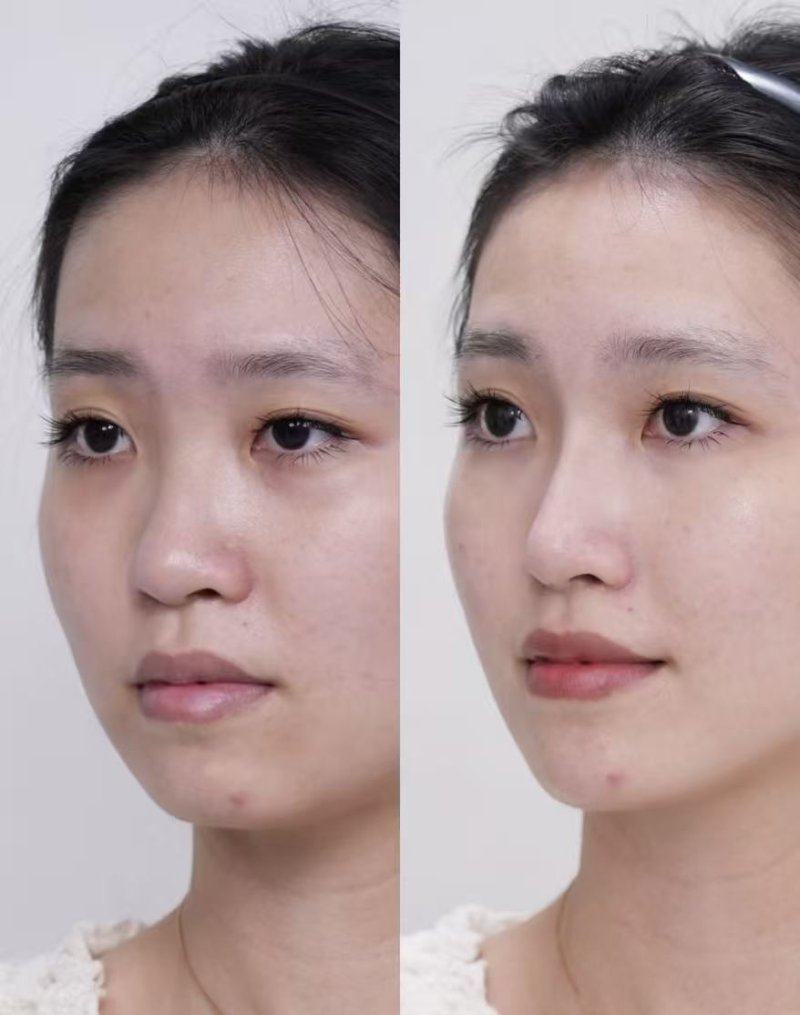 重庆奥斯蒂娜医学美容医院预约挂号方式：