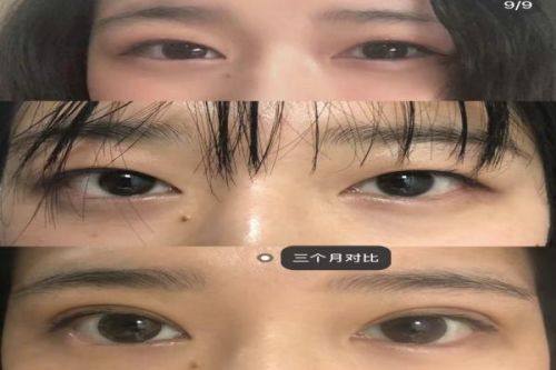 白永明医生在线问诊