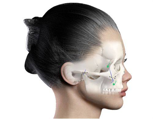 三、激光祛疤的治疗次数与实际成效参考