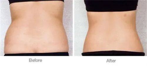 三、双眼皮遗传并非严格遵循单基因显隐性规律