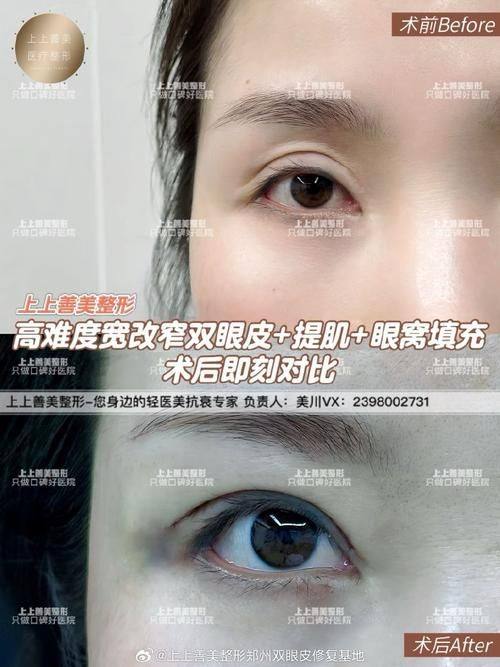 Wichuda医生技术优势：