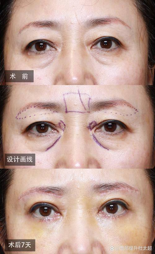 河南开封时光整形价格表：