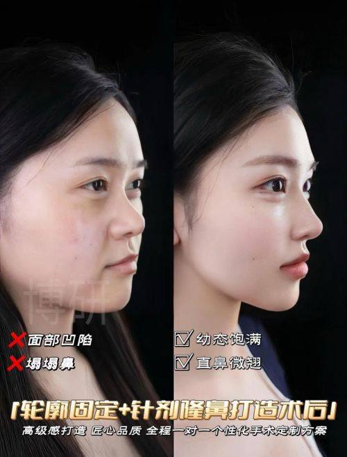 廊坊久安瑞和妇产医院擅长项目：