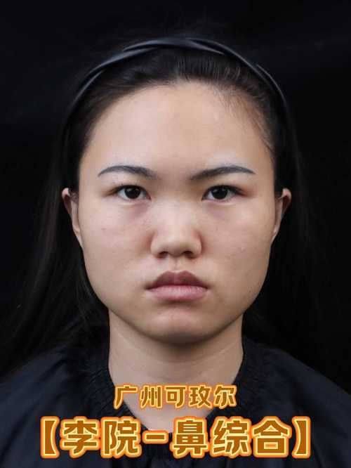 重庆珂琳雅医疗美容口碑评价：