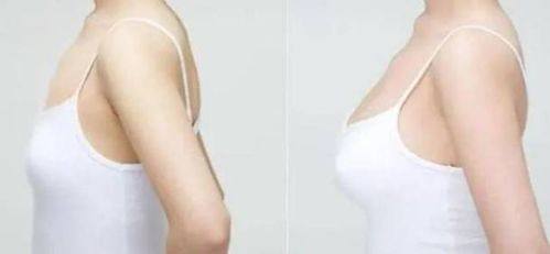 咸宁辰星医疗美容价格表