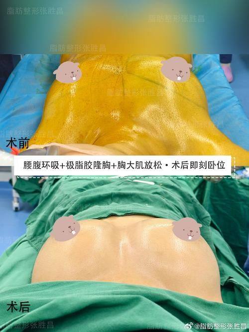 深圳沁科妍医疗美容诊所医生名单及擅长领域：