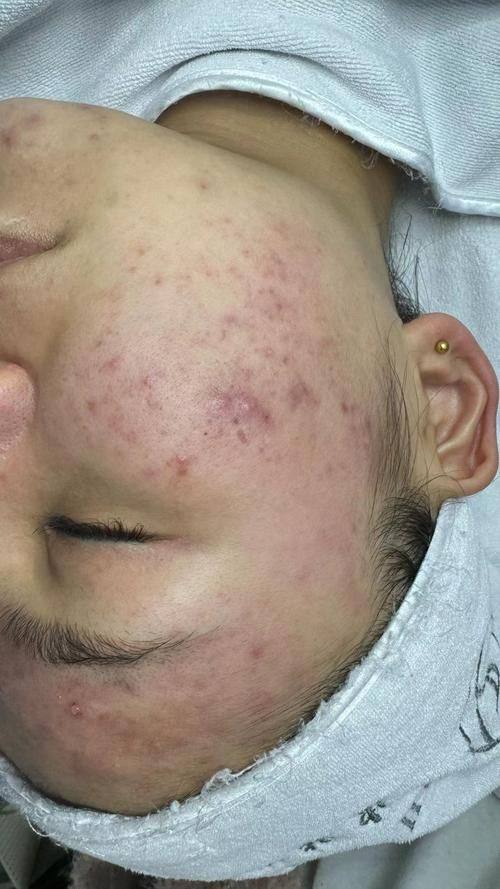 Day View皮肤科预约挂号方式：