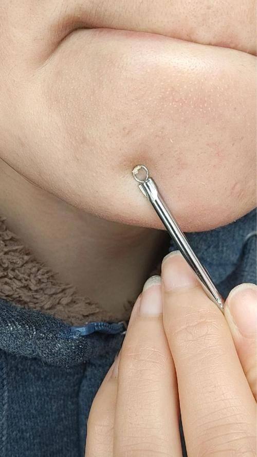 佟以萍医生怎么预约